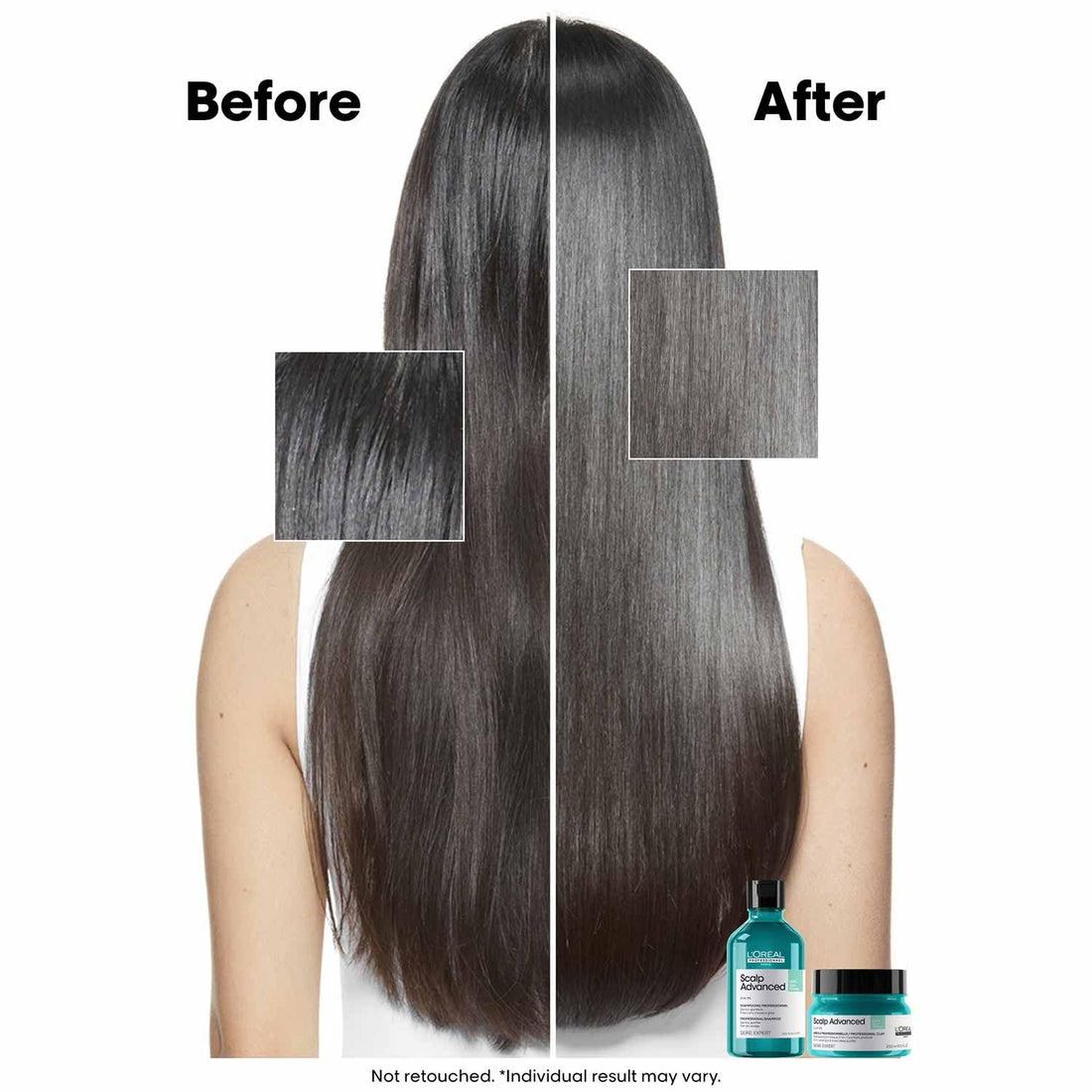 L’Oréal Professionnel Scalp Advanced Anti-Oiliness Dermo-Purifier Shampoo - Shringar Bazaar
