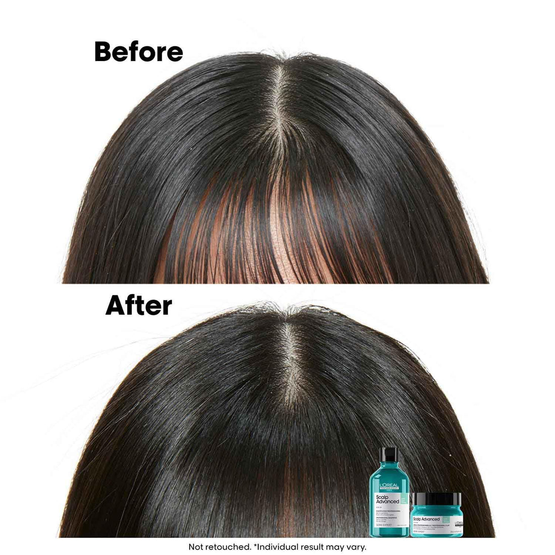 L’Oréal Professionnel Scalp Advanced Anti-Oiliness Dermo-Purifier Shampoo - Shringar Bazaar