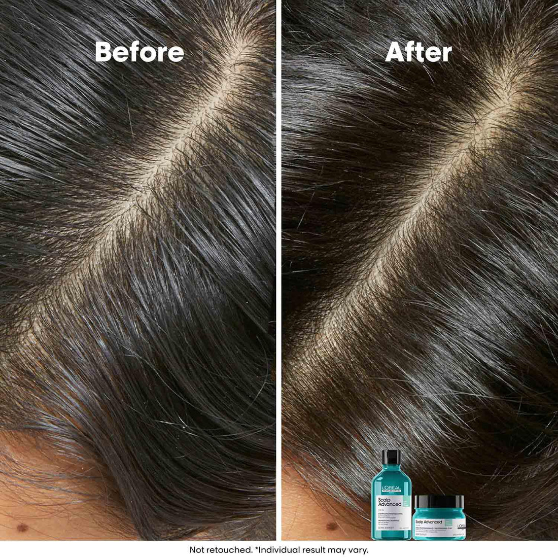 L’Oréal Professionnel Scalp Advanced Anti-Oiliness Dermo-Purifier Shampoo - Shringar Bazaar